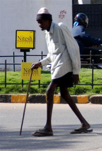 World's skinniest legs!